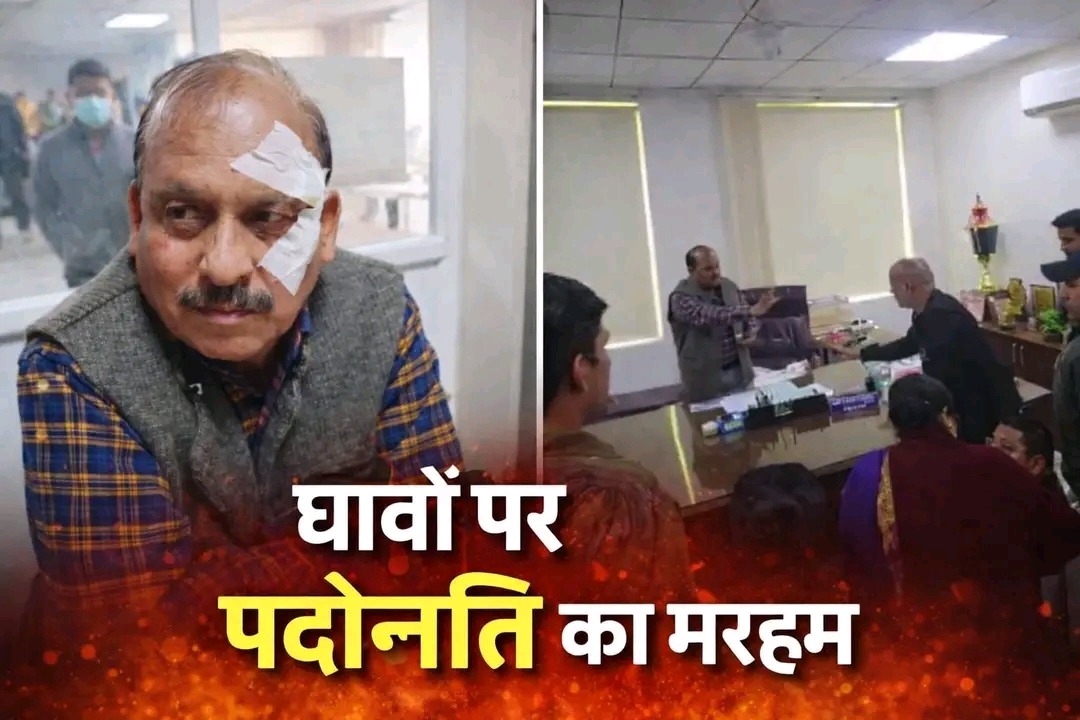 शिक्षा निदेशक के घावों पर शासन का मरहम, रिटायरमेंट से दो दिन पहले प्रमोशन.