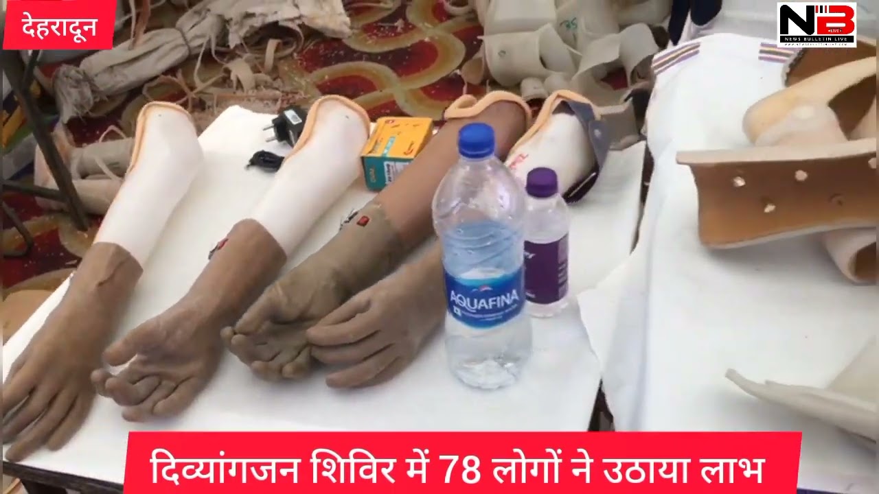 दिव्यांगजन शिविर में 78 लोगों ने उठाया लाभ