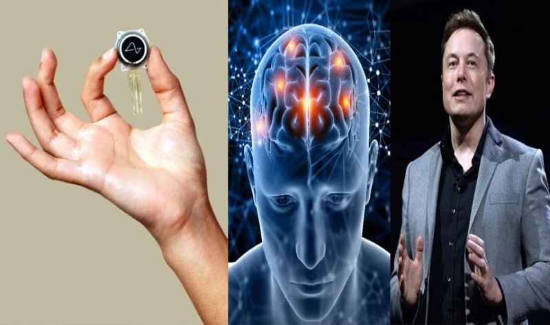 मानव दिमाग में चिप लगाने की मिली मंजूरी, साल के अंत तक पूरा होगा पहला ट्रायल