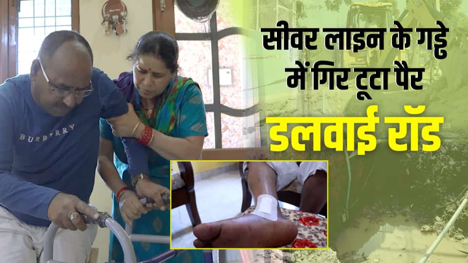 सीवर लाइन के गड्ढे में गिर टूटा पैर, डलवाई रॉड