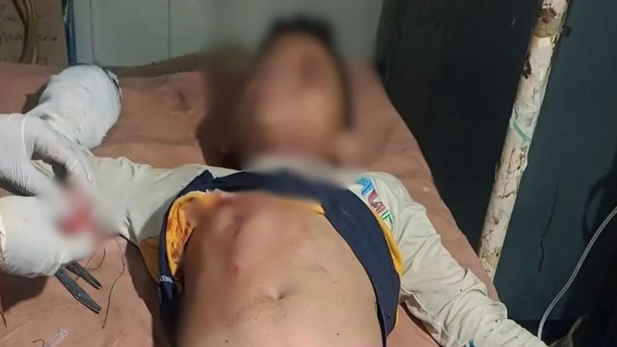 नैनीताल में बारूद से भरी बोतल फटने से तीन किशोर झुलसे, एक की हालत गंभीर, ऋषिकेश रेफर