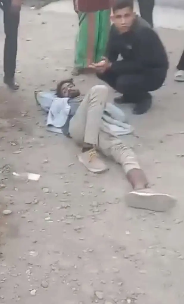 पेड़ की टहनी गिरी बाइक सवार की टूटी टांग