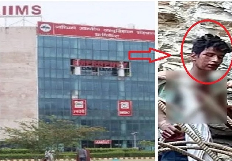 ऑपरेशन कर निकाली गई छाती में आर-पार हुई लोहे की सरिया: सफल सर्जरी