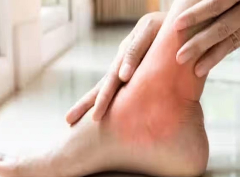 यूरिक एसिड का रामबाण इलाज,,,जड़ से खत्म हो जाएगी बीमारी...