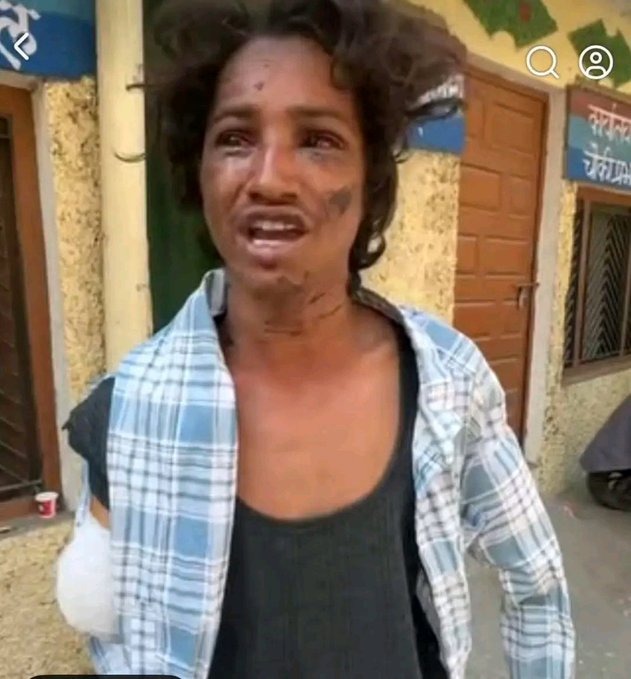 घनसाली के लस्याल गांव में भाई-भाई का खूनी विवाद, छोटे भाई के दोनों हाथ काटे