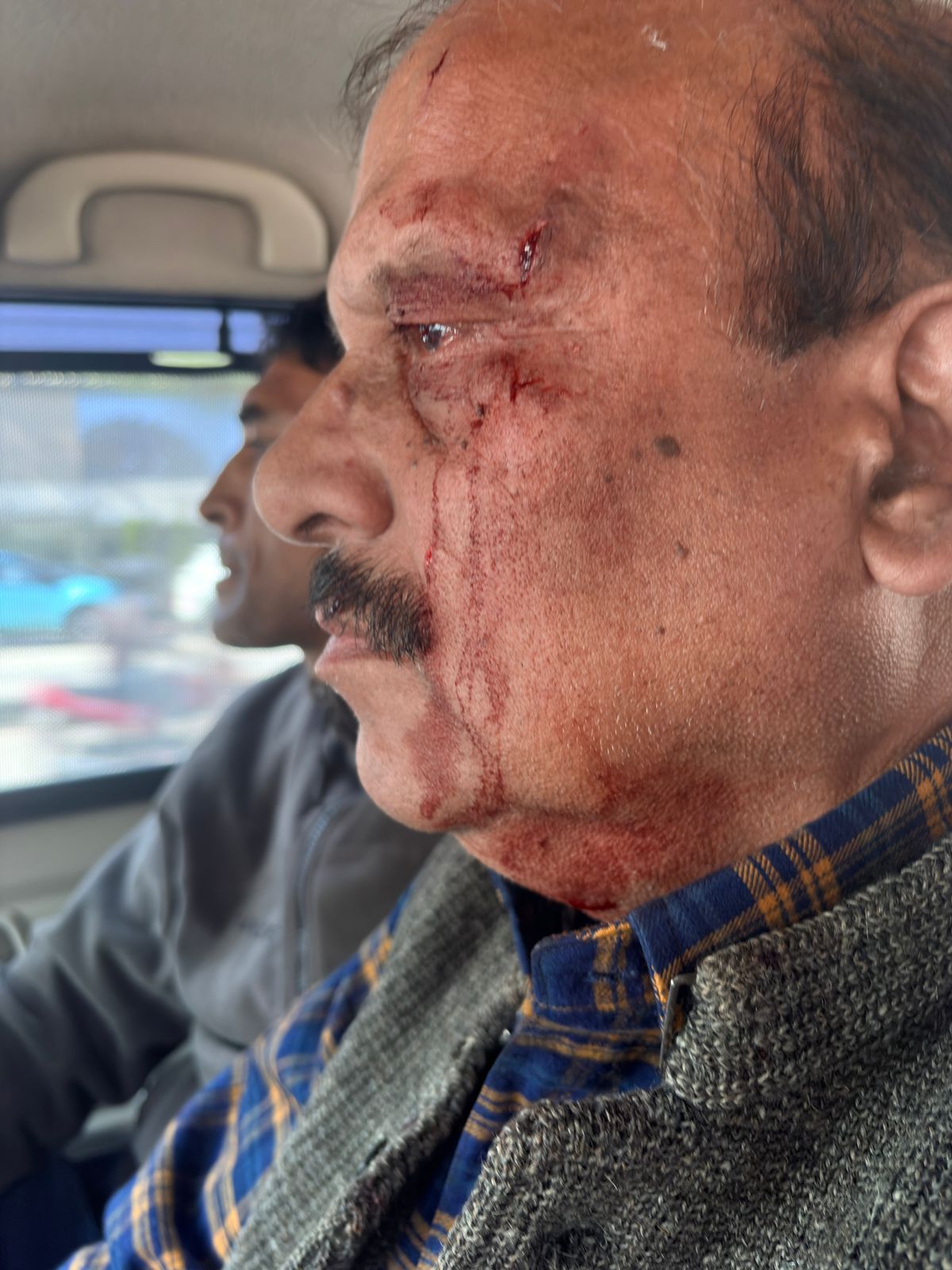 Breaking News:शिक्षा निदेशालय में भारी बवाल, निदेशक पर हमला.