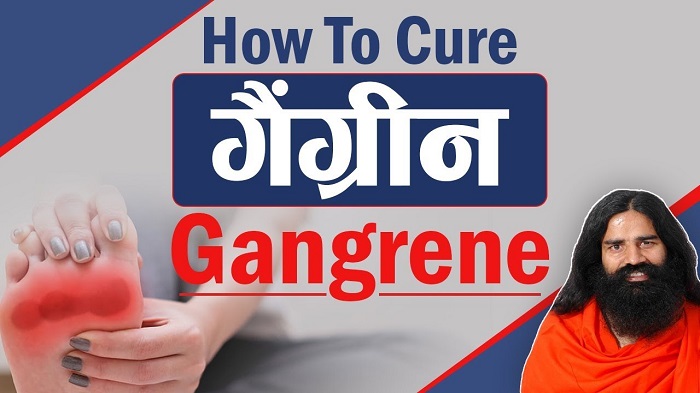 गैंग्रीन का आयुर्वेदिक उपचार : गैंग्रीन रोग शरीर में किसे नुकसान पहुंचाता है